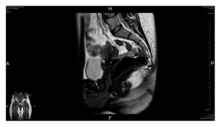 Figure 13