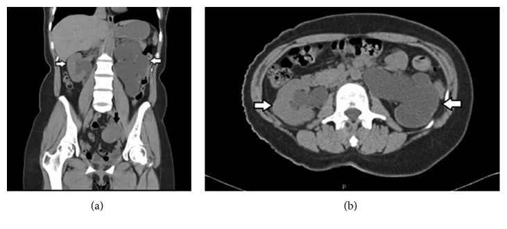 Figure 12