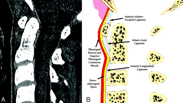 Fig 3.