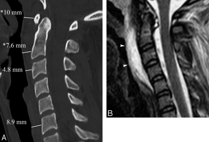 Fig 2.