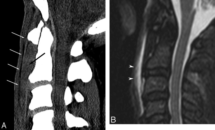 Fig 4.