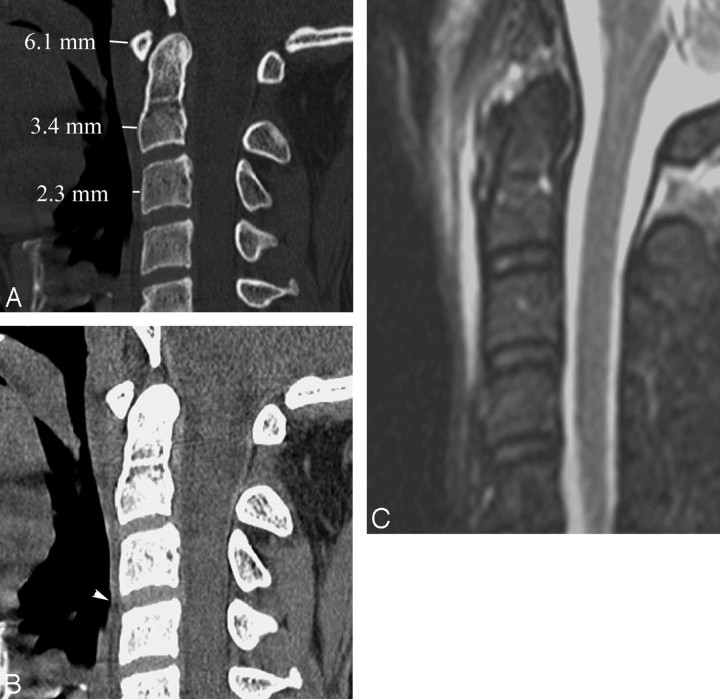 Fig 5.