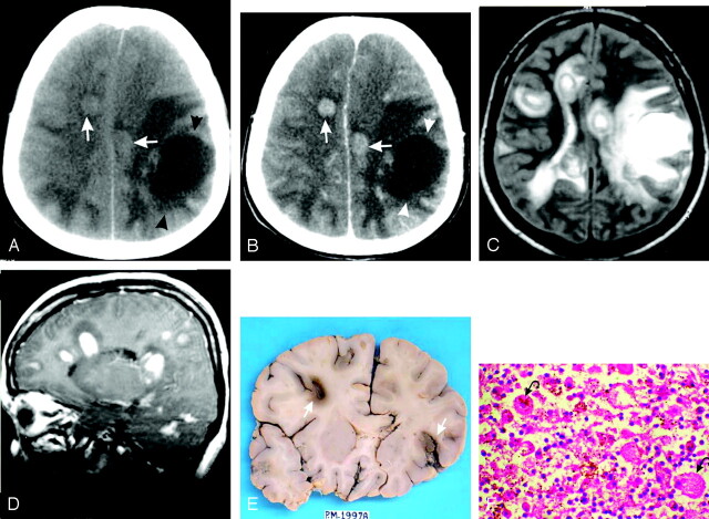 Fig 3.