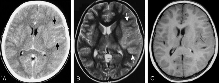 Fig 2.