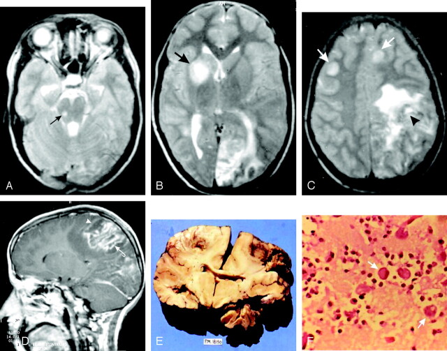 Fig 1.