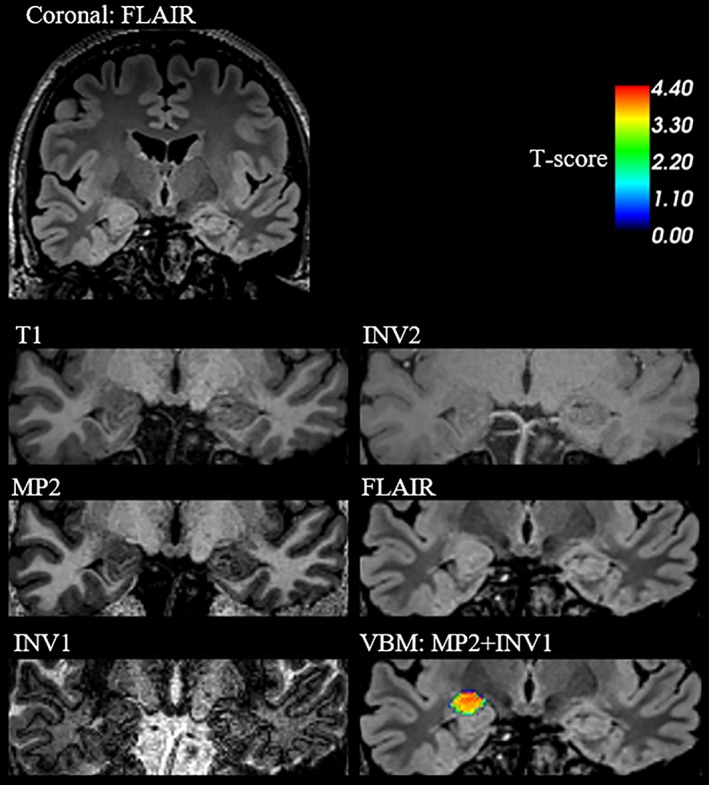 Figure 6