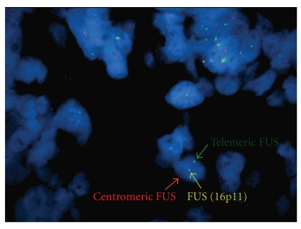 Figure 4