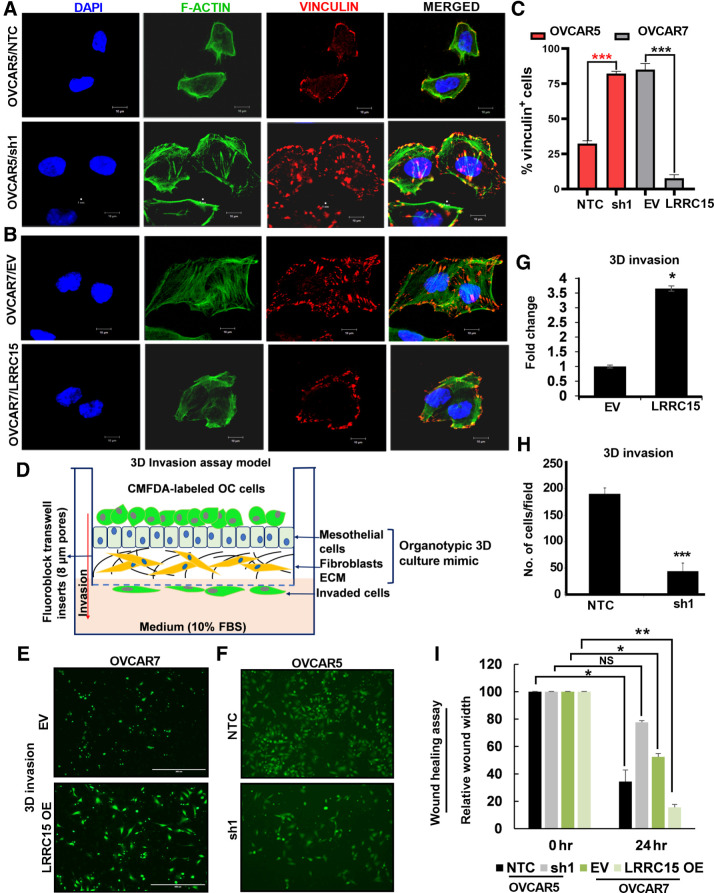 Figure 4. Altered LRRC15 expression reveals distinct pattern of FA complex formation in ovarian cancer cells. A, OVCAR5 NTC and sh1 cells were grown on fibronectin-coated coverslips for 24 hours, followed by immunofluorescence study against F-actin (green) and vinculin (red) using the confocal microscopy. DAPI was used to stain the nucleus, and the merged images are represented. B, Similar immunofluorescence assay was performed in the OVCAR7 EV and LRRC15 OE cells, and the images are provided. Scale bar, 10 μm. C, Percentage of vinculin-positive cells in a total of 50 cells was counted and is represented as bar graph. D, Schematic representation of the invasion assay through the organotypic 3D culture model of the omentum surface. E, CMFDA-labeled EV control and LRRC15 OVCAR7 cells were allowed to invade the 3D culture matrix for 12 hours, and the representative images were provided. F, Similar invasion assay was performed in the OVCAR5 NTC and sh1 cells. G–H, Percent of invaded cells was scored for the 3D invasion assay and is presented as mean ± SEM, respectively. I, Wound healing assay was performed in the OVCAR5 NTC and sh1 cells, and in the EV control and LRRC15 OE OVCAR7 cells, the relative wound width was calculated using the ImageJ software and is represented. NS, not significant; *, P < 0.05; **, P < 0.01; ***, P < 0.001.