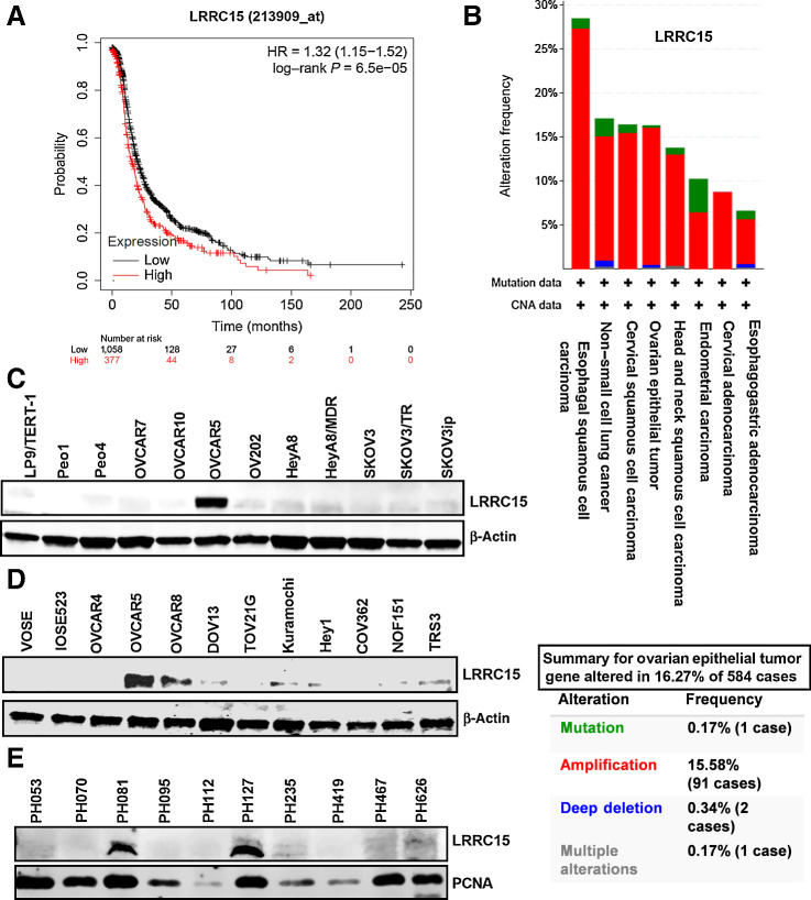 Figure 1. LRRC15 is associated with ovarian cancer. A, Kaplan–Meier progression-free survival analysis shows high LRRC15 expression is associated with worse progression-free survival in a cohort of 1,436 patients with ovarian cancer. B, TCGA analysis of LRRC15 expression in several cancer types along with the percent gene altered as evaluated in the ovarian epithelial tumor. C and D, Immunoblot analysis of LRRC15 in ovarian cancer cell lines and in the ovarian cancer fibroblast cell lines NOF15hTERT and TRS3 and in the normal ovarian surface epithelial cells VOSE and IOSE523. β-actin was used as loading control. E, Western blot analysis of LRRC15 and proliferating cell nuclear antigen (PCNA) expression as control in 10 ovarian cancer PDX tumors.