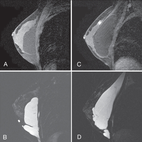 Figure 10)