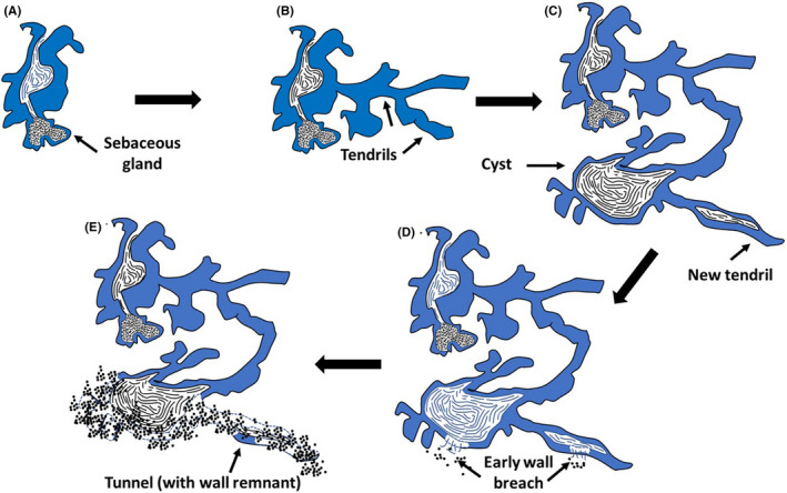 FIGURE 4