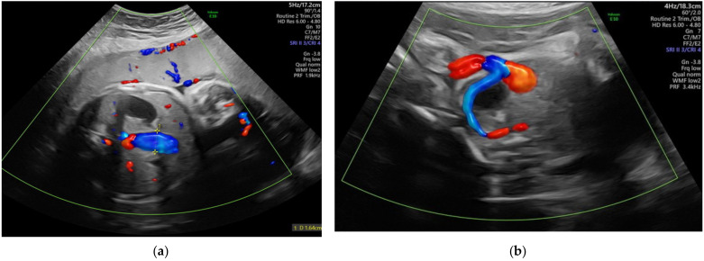 Figure 11