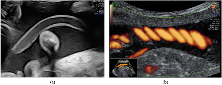 Figure 13