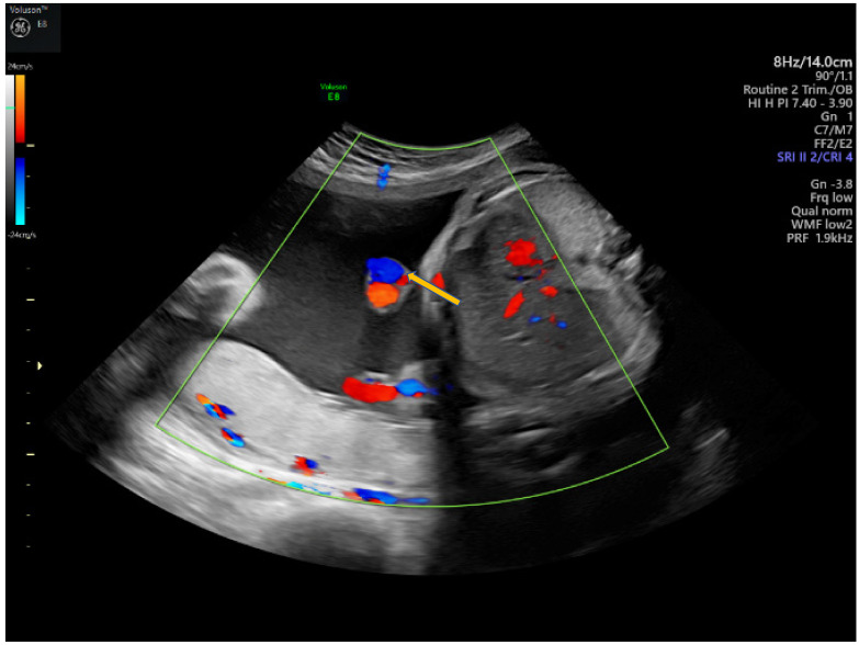 Figure 6