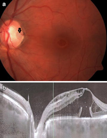 Fig. 1