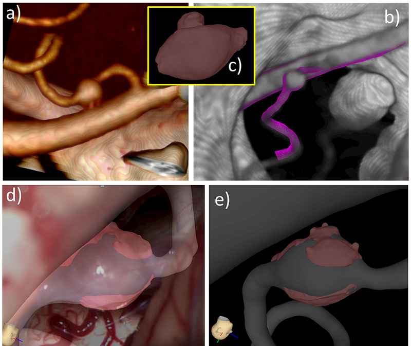 Figure 14: