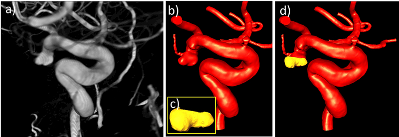 Figure 11: