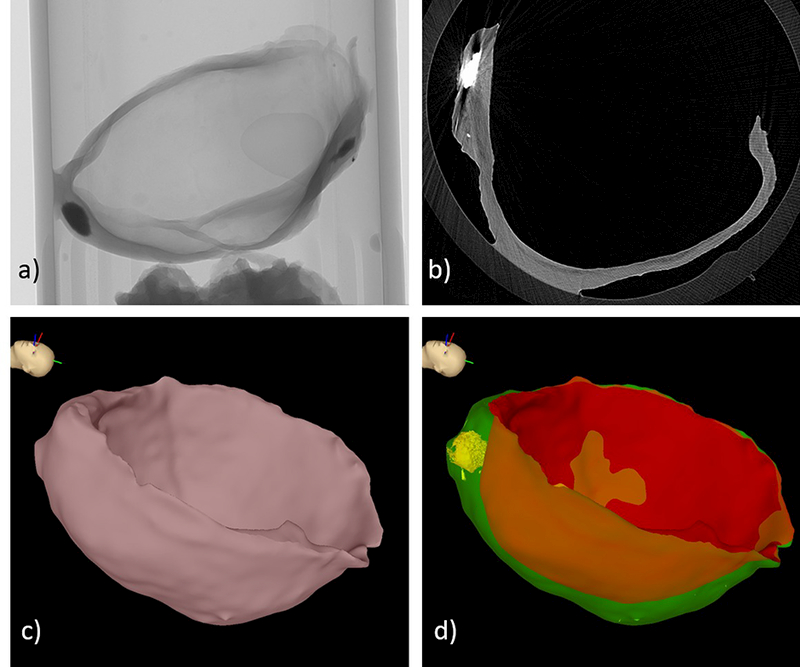 Figure 2: