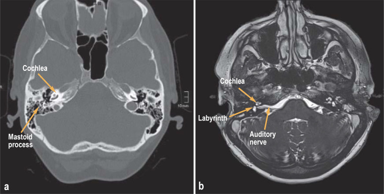 Figure 1: