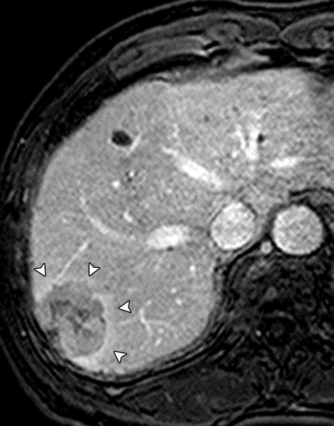 Figure 7c: