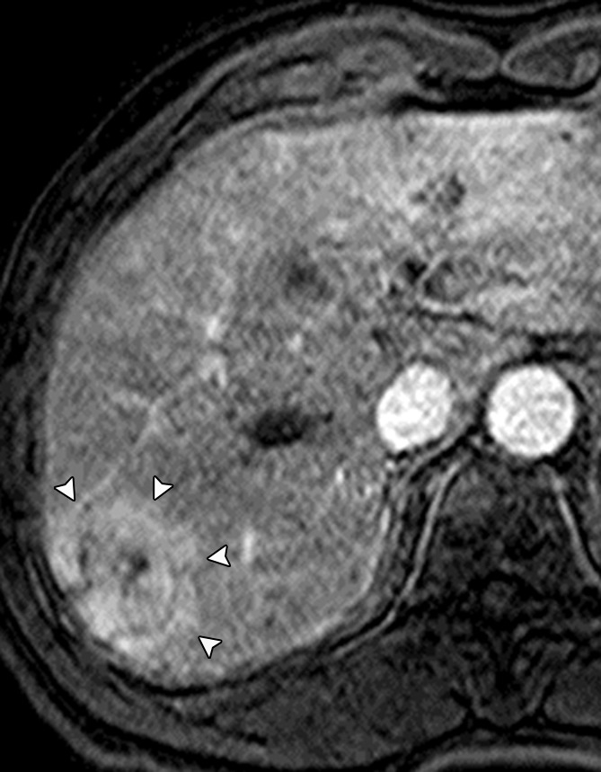 Figure 7b: