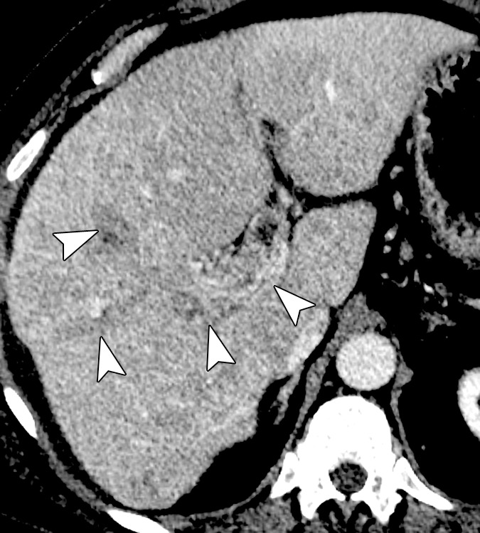 Figure 3b: