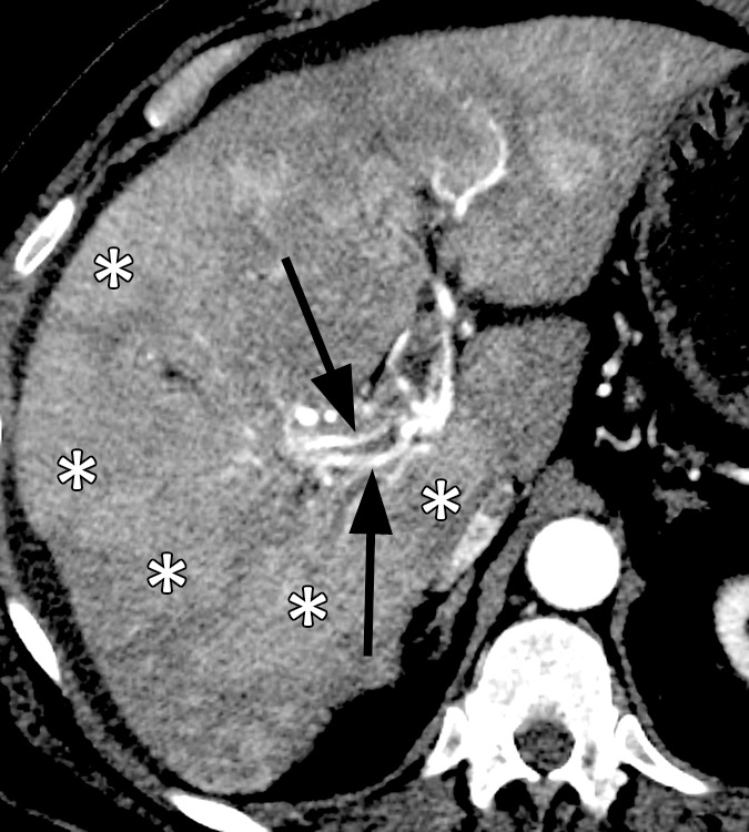 Figure 3a: