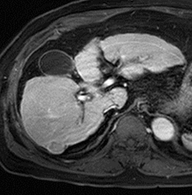 Figure 5c: