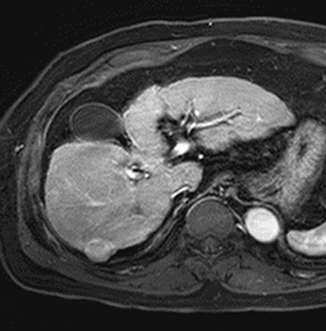 Figure 5b: