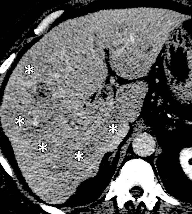 Figure 3c: