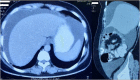 Fig. 2