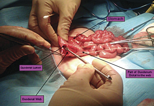 Figure 2: