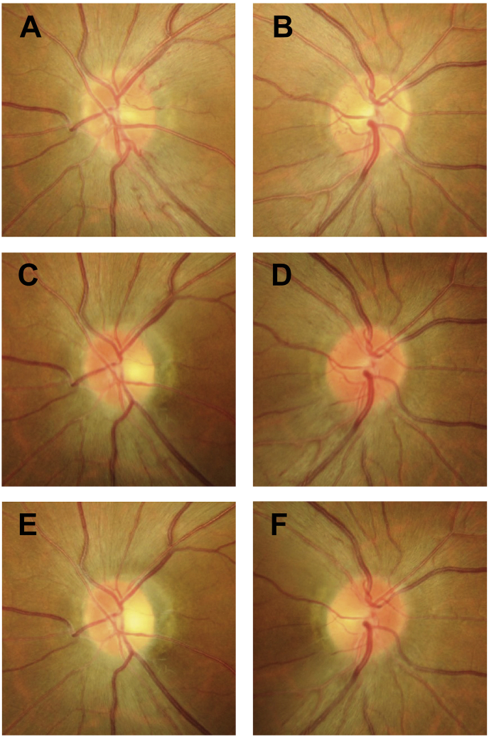 Fig. 3