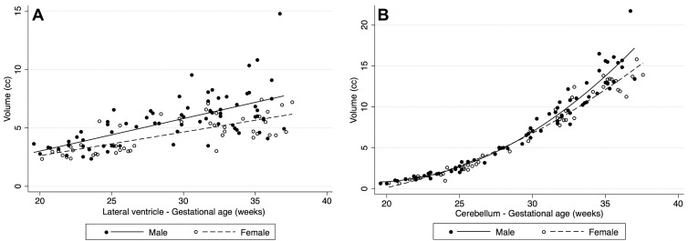 Plots show volumetric differences by sex. In structures with sexual dimorphism, male fetuses had higher volumes on average: (A) shows rates for the lateral ventricles and (B) for the cerebellum.