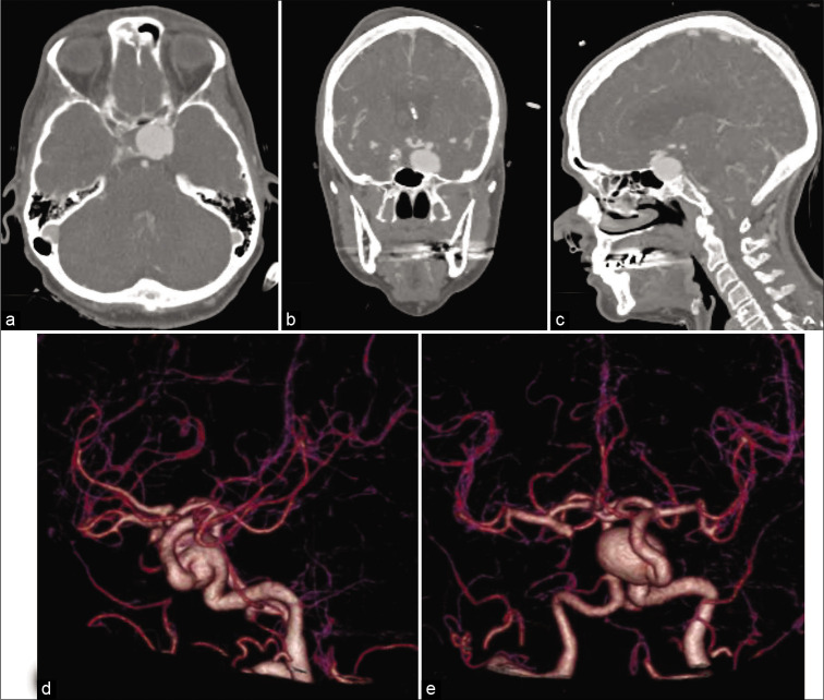 Figure 2: