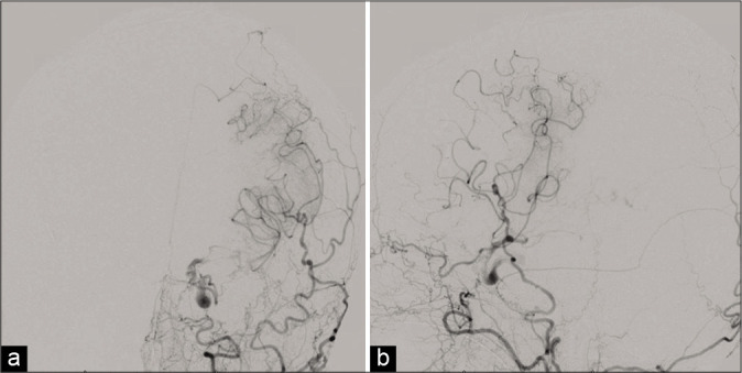 Figure 4: