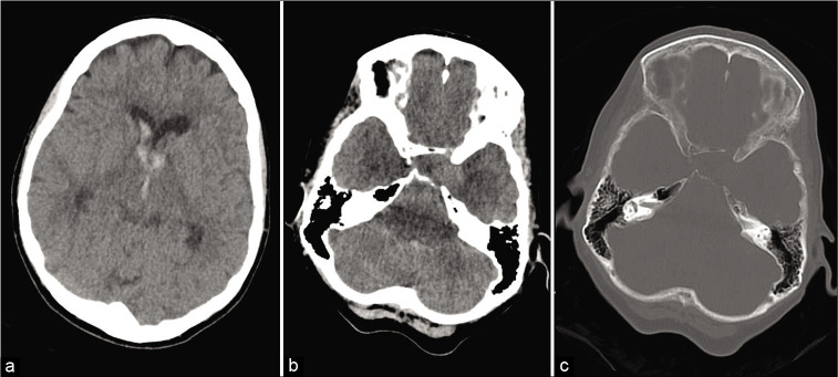 Figure 1: