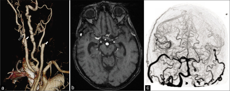 Figure 6: