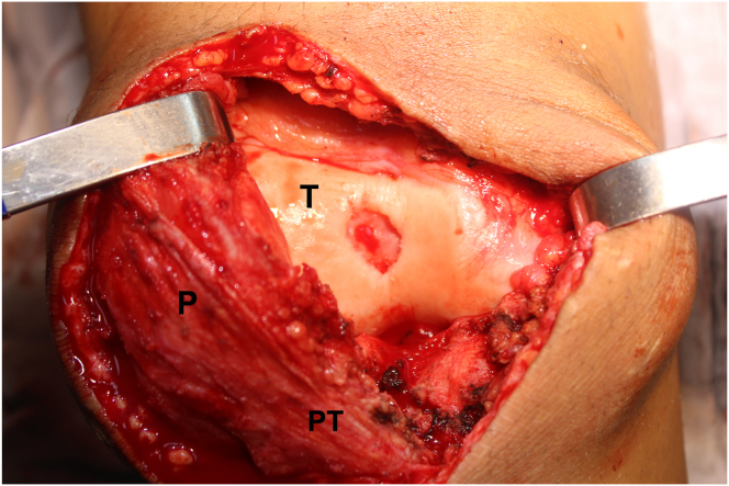 Fig 4