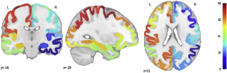 Fig. 1