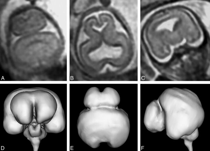 Fig 6.