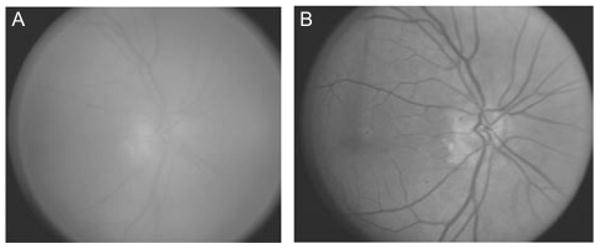 FIGURE 3