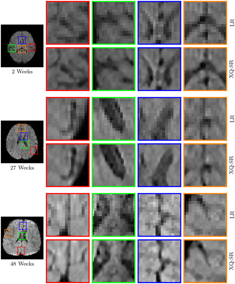 Figure 11: