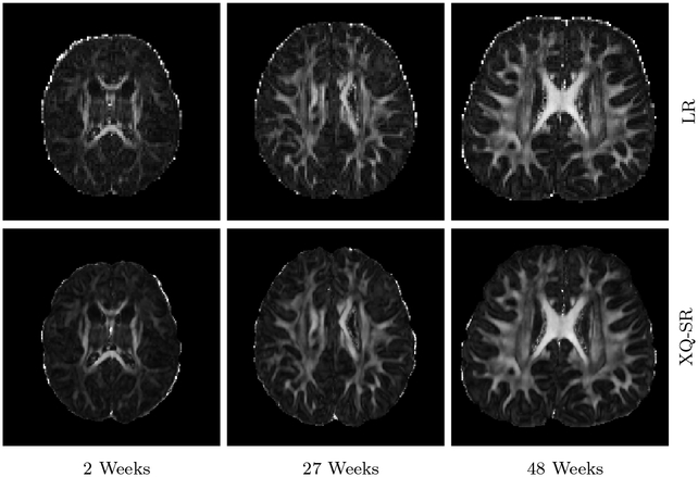 Figure 12: