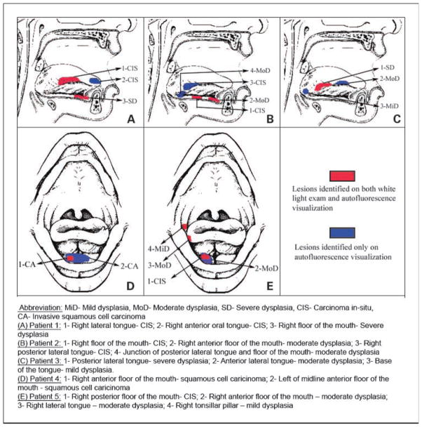 Fig. 4