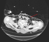 Fig. 10