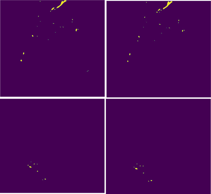 Fig. 11