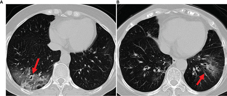 Figure 1