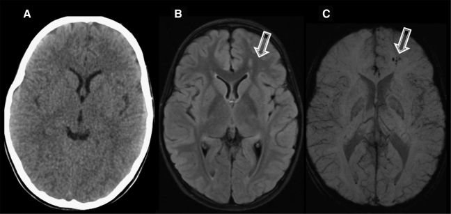 FIG. 1.