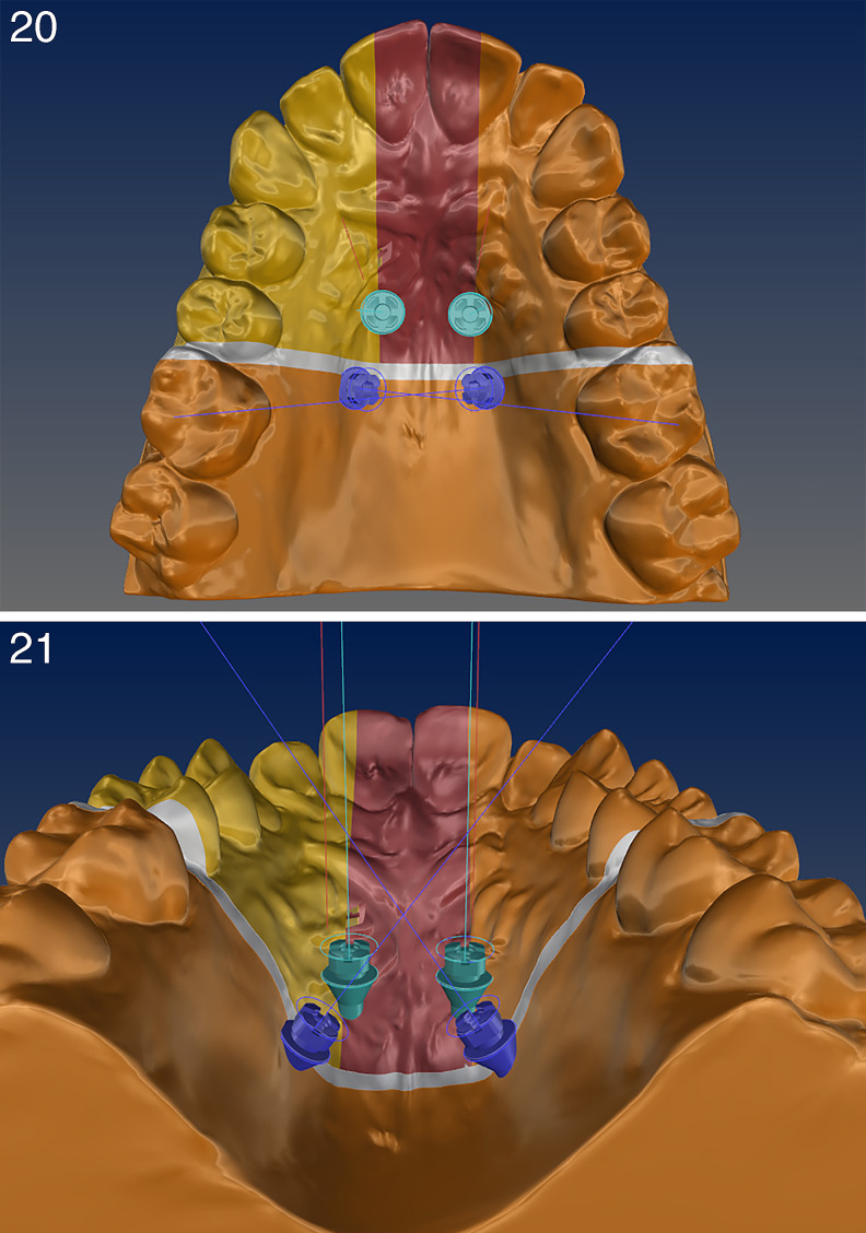 Figures 20–21.